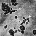 Photographic proof of the cancer germ (1912)