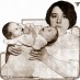 Conjoined twins amaze scientists (1914)