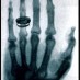 X-ray wonders (1896)