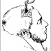 Modern brain surgery, 1890s-style (1893)