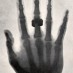 Make your own X-rays at home (1896)