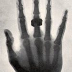 xray-hand-1896