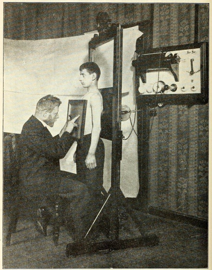 How Xrays were discovered in the 1890s momentous Victorian medical