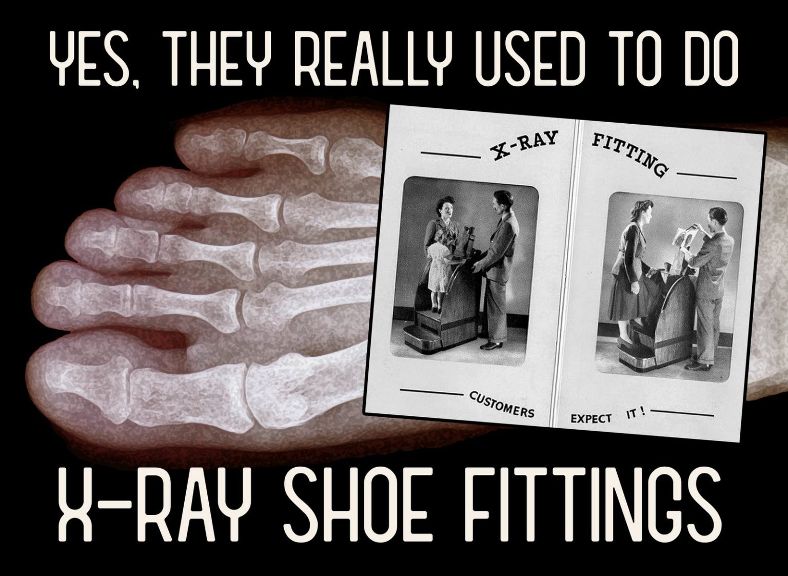 How Xray shoe fittings used to really be a thing years ago Click