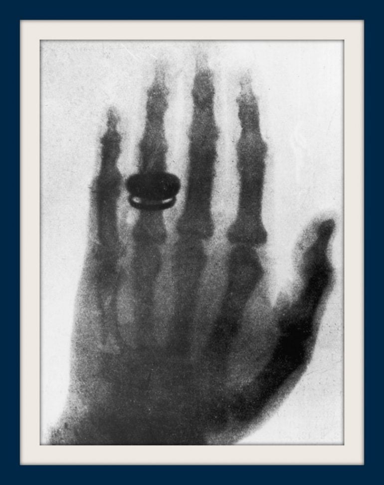 How Xrays were discovered in the 1890s momentous Victorian medical