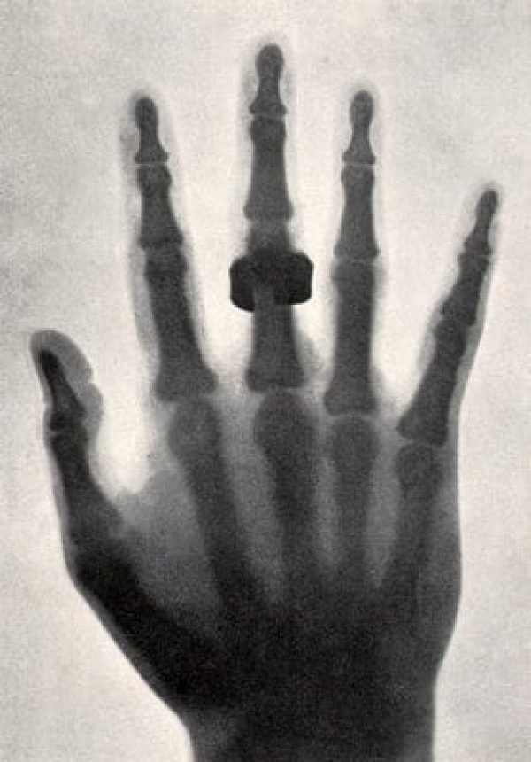 Make your own Xrays at home (1896) Click Americana